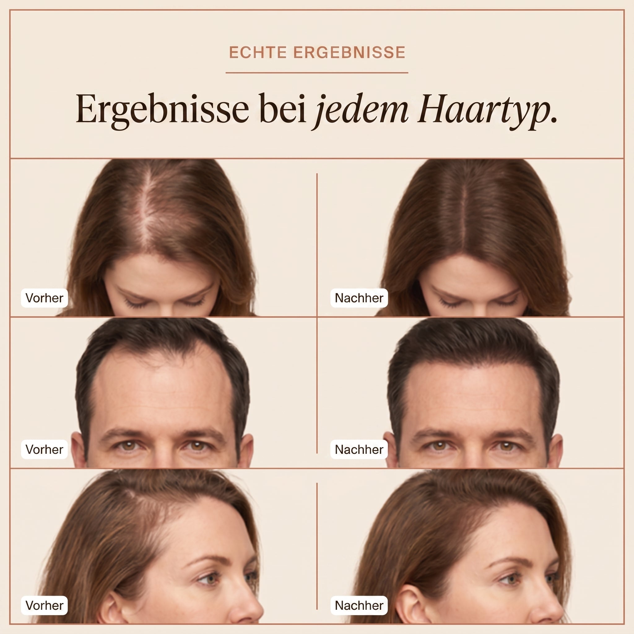 ZeNevo™ Grow:Turn Ampoule Korea's №1 Hair Growth Secret – Jetzt in Deutschland